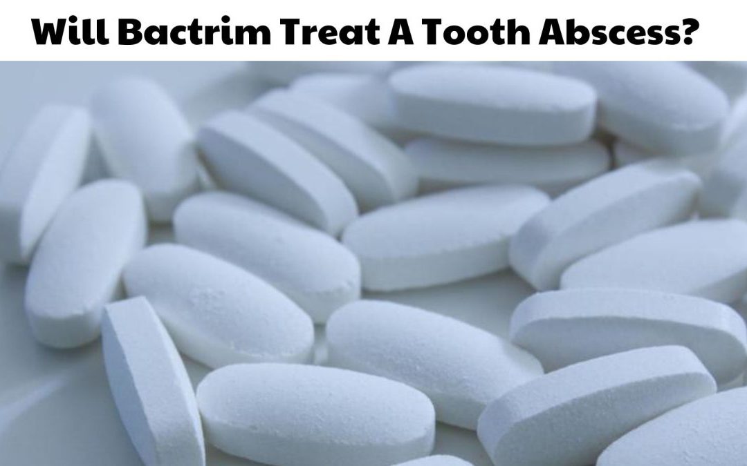 Bactrim for Tooth Infection